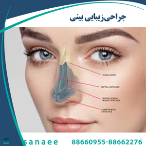 جراحی زیبایی بینی