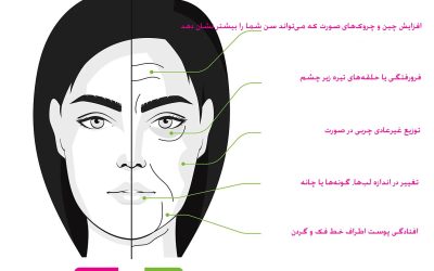 صورت اوزمپیک: علت، علائم و روش‌های پیشگیری و درمان